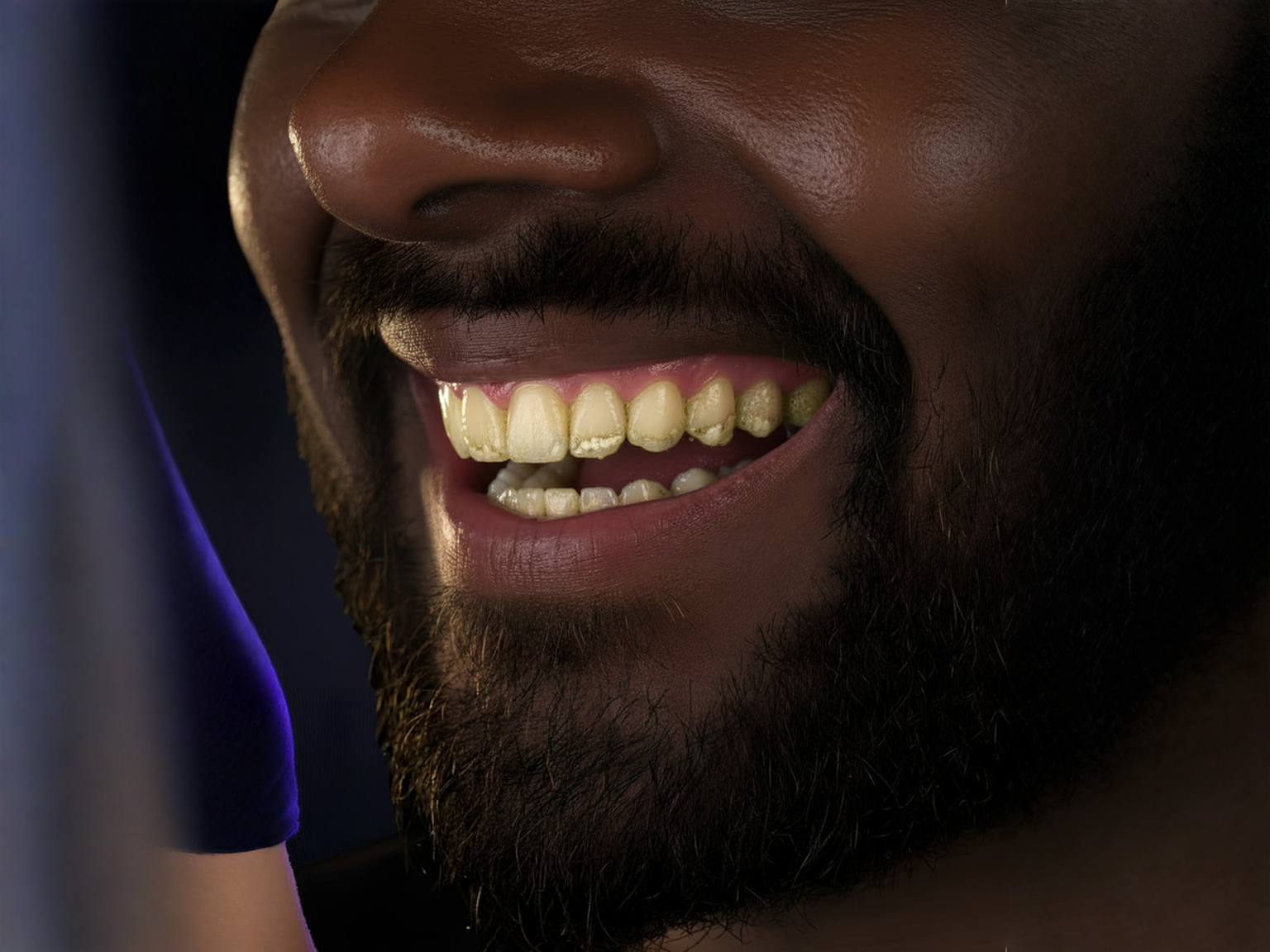 The Hormonal Disadvantage: Testosterone and Plaque Buildup